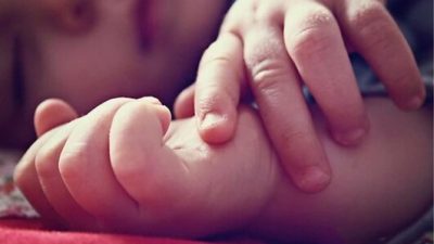 Bayi Bermata Satu Lahir di Yaman