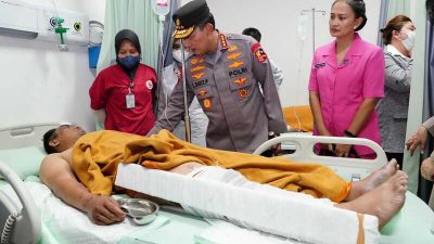 Kapolda Jambi dan Rombongan dalam Perawatan Maksimal RS Bhayangkara